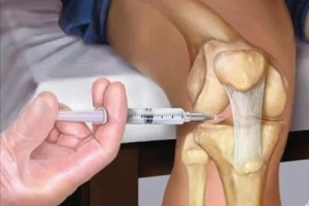 زنگ خطر دیابت در ایران؛ ۹ میلیون نفر در آستانه ابتلا